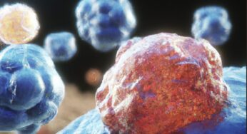 Nie wieder Krebs – Wissenschaftlicher Durchbruch bringt stärkste Waffe gegen Krebs hervor