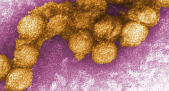 Neue Seuche mit hohen Todesfallzahlen breitet sich aus