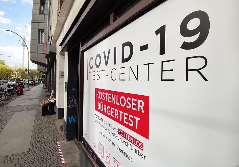 Forscher identifizieren möglichen Biomarker für Long Covid